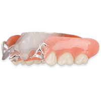 Cast Partial