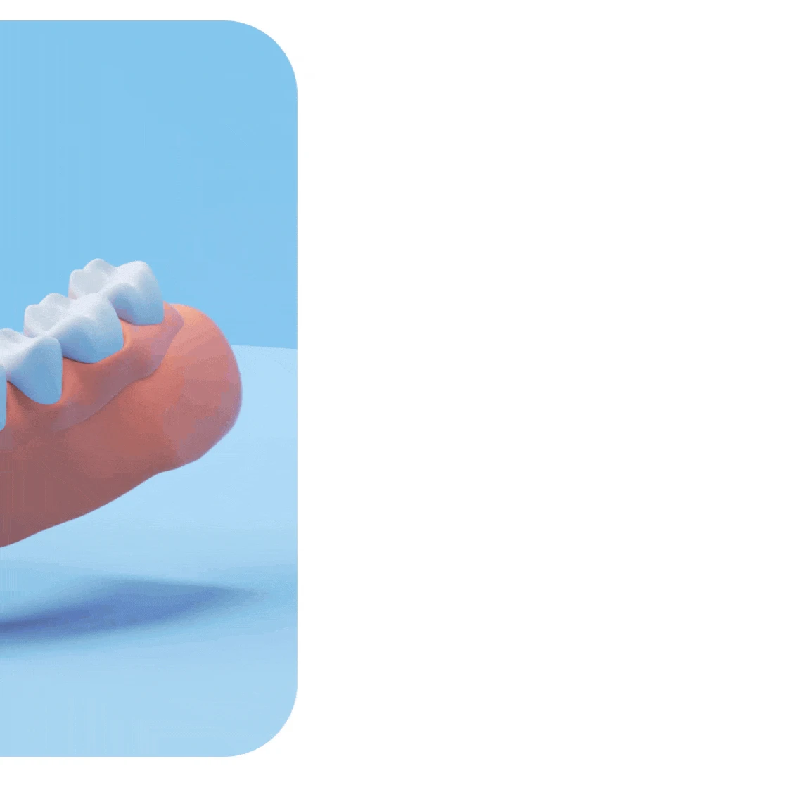 GIF of a dental implant in gums, showing the screw, abutment, and crown against a blue backdrop.
